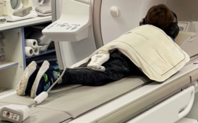 Sheffield company pioneering stem cell therapies thanks to funding scheme