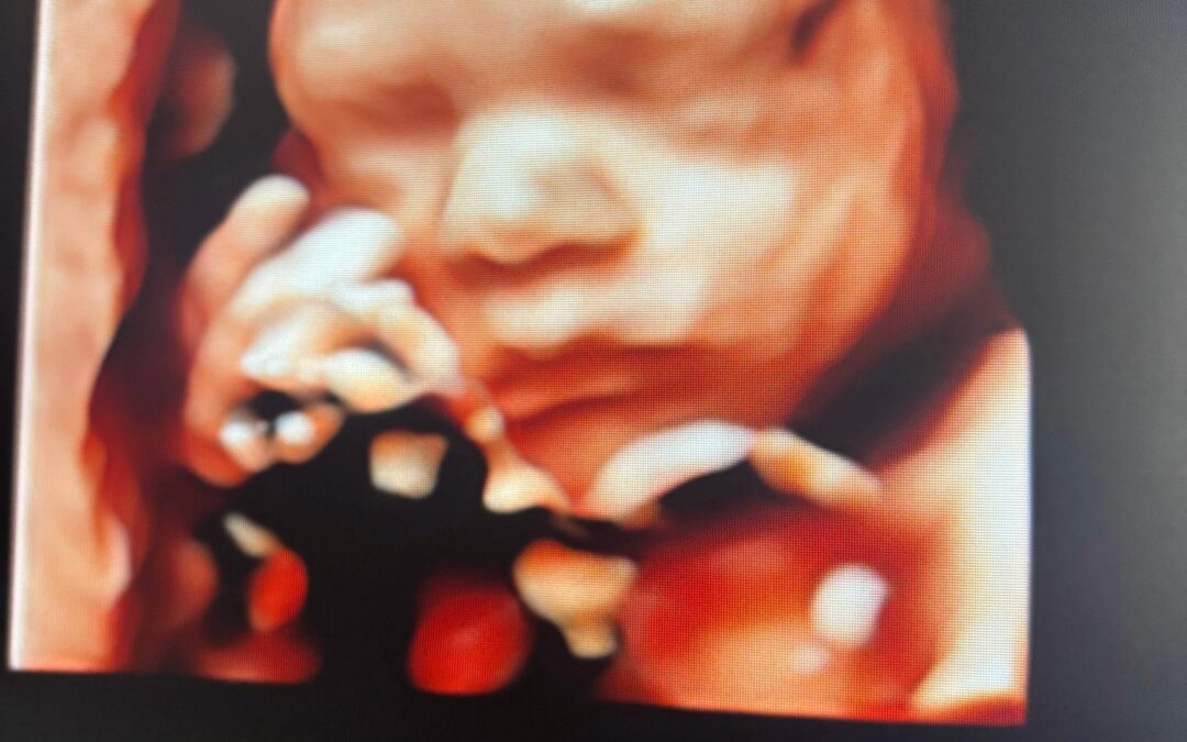 New Sheffield clinic offers earlier baby gender scans for expectant parents