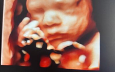 New Sheffield clinic offers earlier baby gender scans for expectant parents