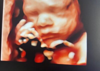 New Sheffield clinic offers earlier baby gender scans for expectant parents